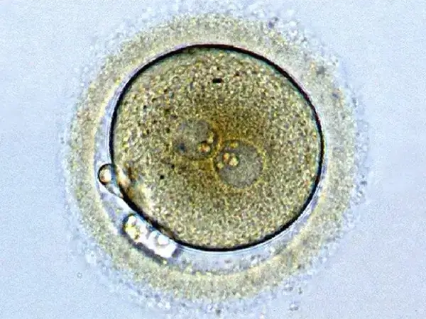 选移植的胚胎要从三个方面考虑