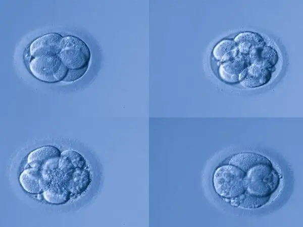 胚胎质量与成功率息息相关