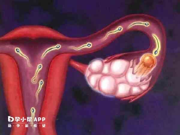 试管婴儿可以直接避开输卵管