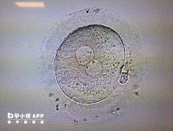 胚胎着床可能会有透明液体流出