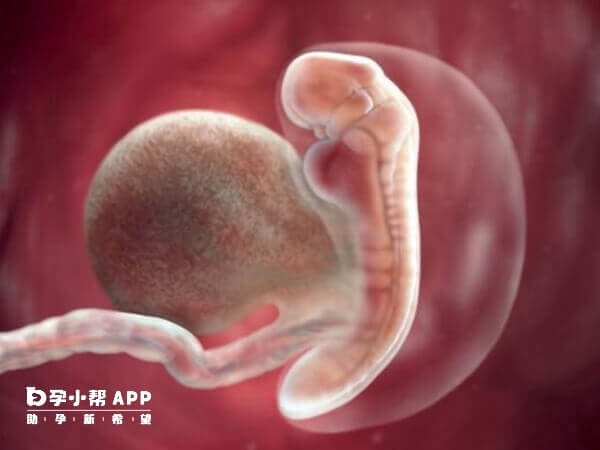 胚胎停止发育多见于胚胎染色体异常
