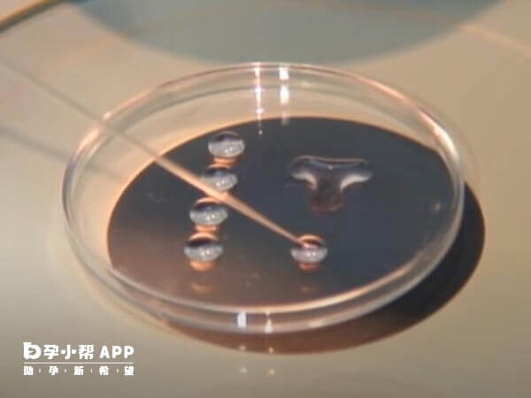 冷冻保存胚胎可以方便日后使用