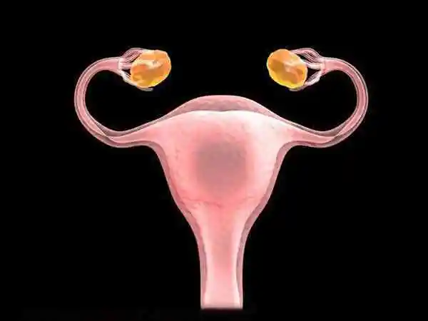 宫腔粘连可能导致子宫内膜发育不良