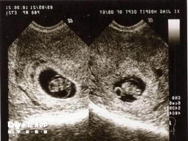 做b超能观察胎儿生长情况