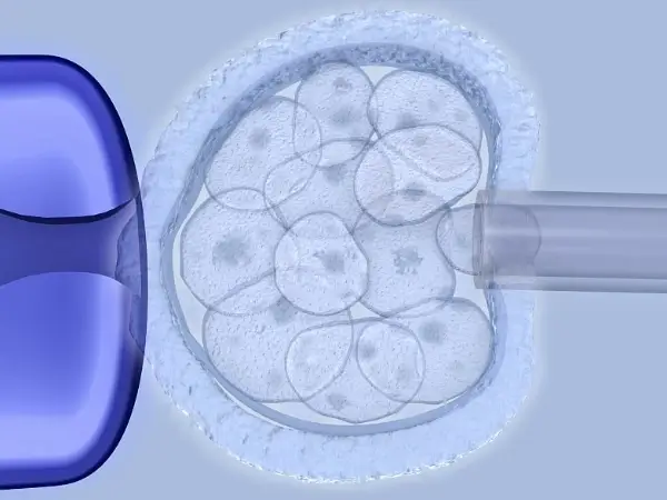 囊胚移植后少量出血是正常的