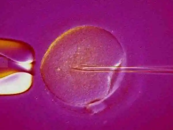 鲜胚移植后要注意饮食规律