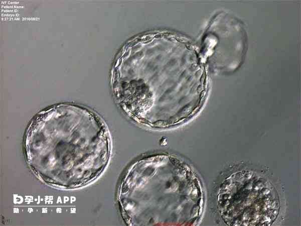 6bb囊胚属于优质胚胎