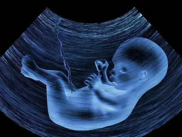 子宫偏小怀孕后要定期孕检