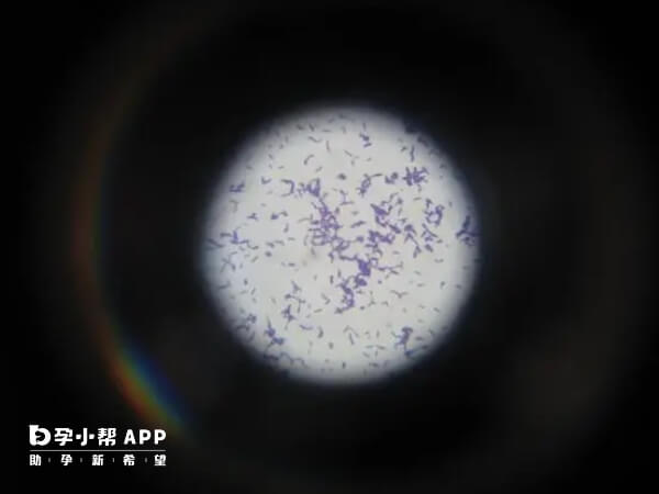 显微镜下的李斯特菌