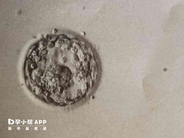 胚胎发育到囊胚后可以进行染色体筛查