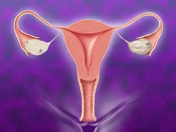 卵巢功能早衰的女性存在怀孕困难的风险
