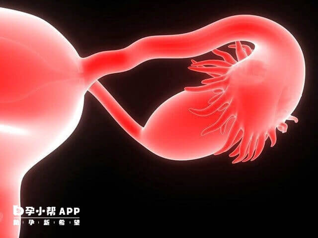 卵巢低反应是一种常见的妇科疾病