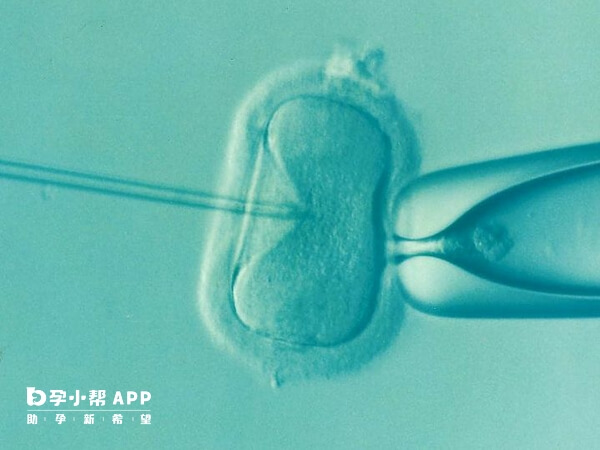导致胚胎的发育慢的因素有很多