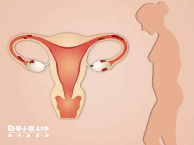 子宫内膜容受性不好会影响受孕率