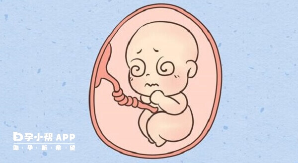 脐带异常胎儿可能出现发育缓慢