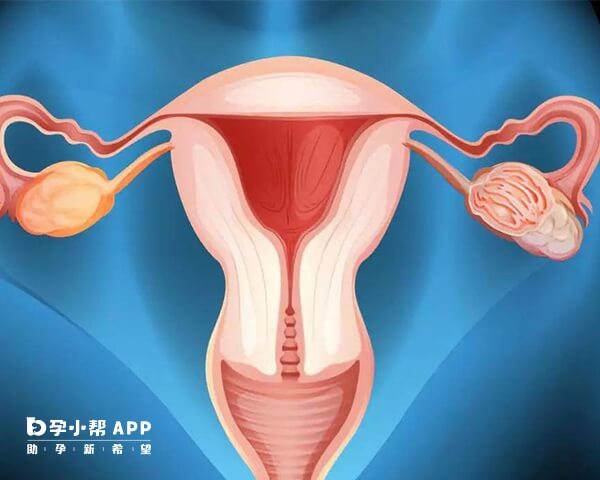 输卵管切除手术能治病也能带来副作用