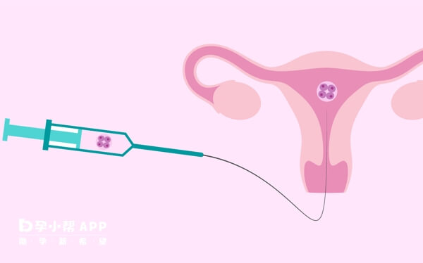 宫腔灌注有利于评估是否可以进行移植