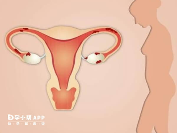 女性要重视子宫内膜和输卵管相关检查