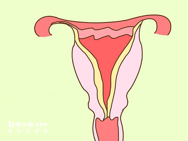宫颈机能不全的孕妇需要做环扎手术