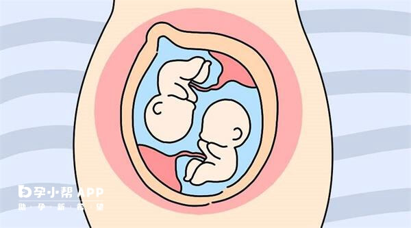 试管婴儿双胎妊娠注意事项