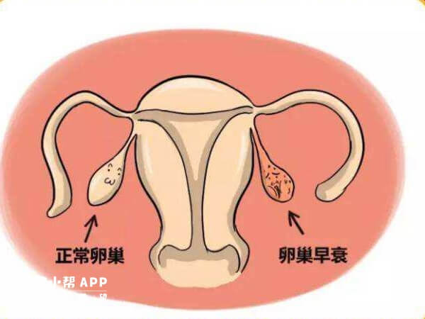 卵巢早衰会多方面影响女性生殖功能