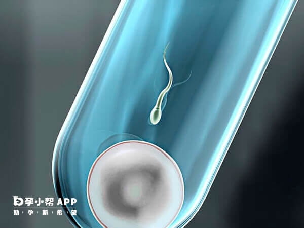 胚胎移植是试管婴儿的步骤之一