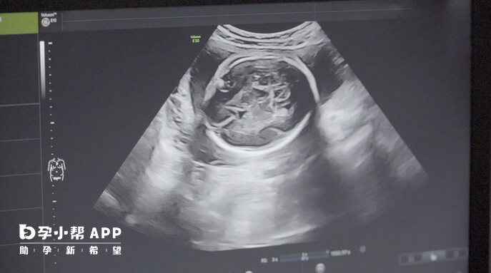 鲜胚移植后B超检查主要看胚胎和子宫状况