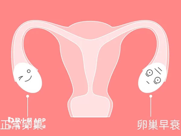 卵巢早衰可以做供卵试管