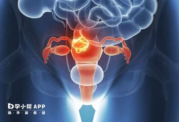 女性卵巢早衰的原因解析