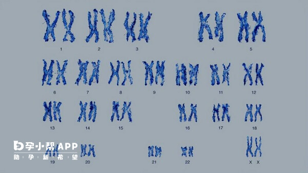 高发人群做染色体筛查能避免染色体异常
