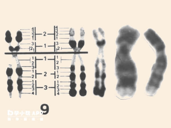 9号染色体异常胚胎着床后易流产