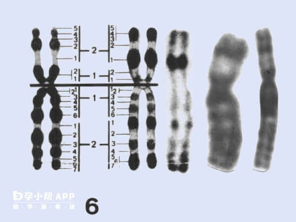6号染色体异常无纠正方法只能放弃移植