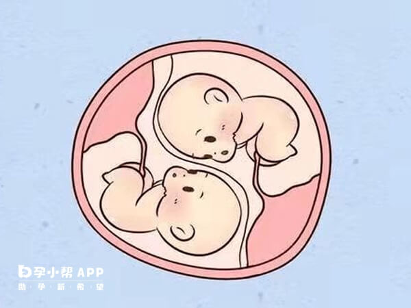 试管婴儿囊胚移植能降低多胎妊娠率