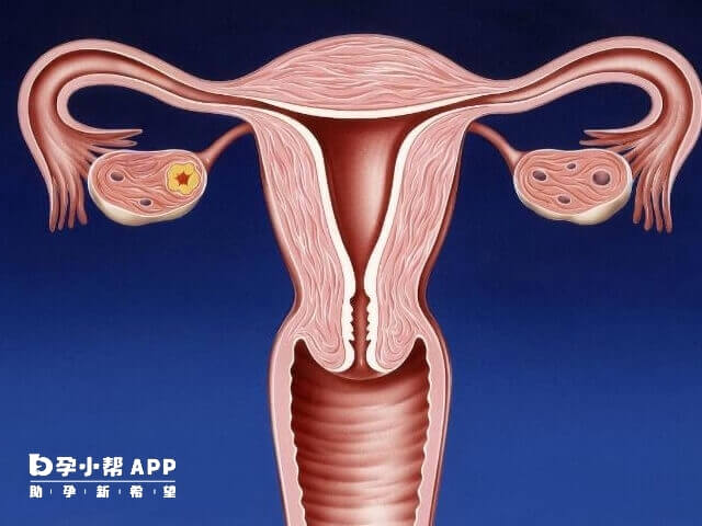 子宫内膜异位症对生育年龄女性危害更大