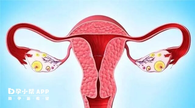 慢性盆腔炎是导致宫外孕的原因之一