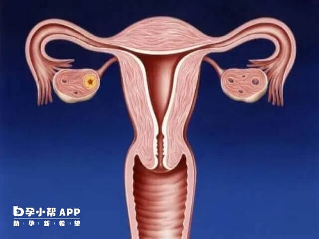 子宫内膜薄做试管的成功案例不少