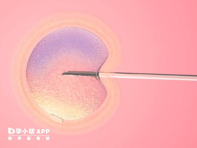 卵巢早衰试管婴儿进周前要积极治疗