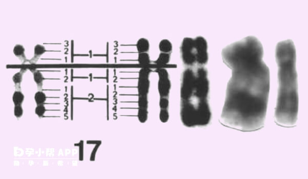 胎儿17号染色体异常大多都和父母有关