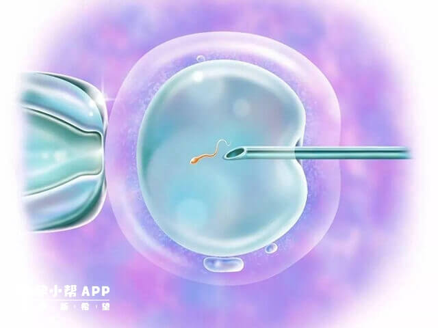 胚胎质量决定三代供卵试管成功率