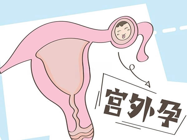 做试管婴儿导致宫外孕的原因