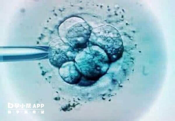 没做染色体检查的优质胚胎也可能移植失败