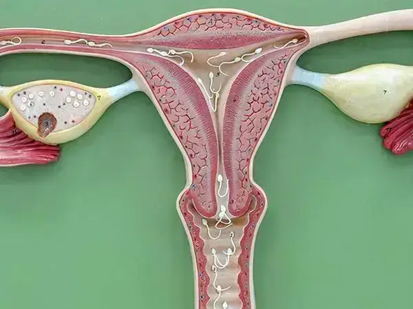 子宫内膜移植方式选择要看患者病情