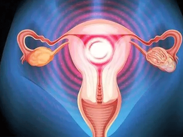 子宫内膜薄调理厚移植也还是需要注意护理