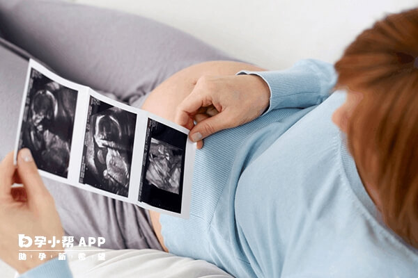子宫畸形是导致女性不孕的原因之一