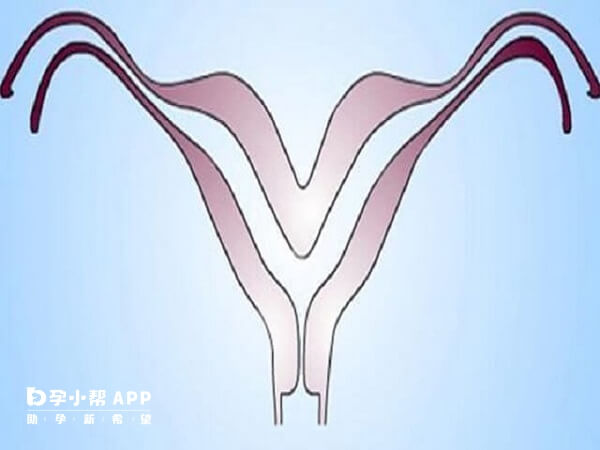 卵巢功能好是弓形子宫做试管的条件之一