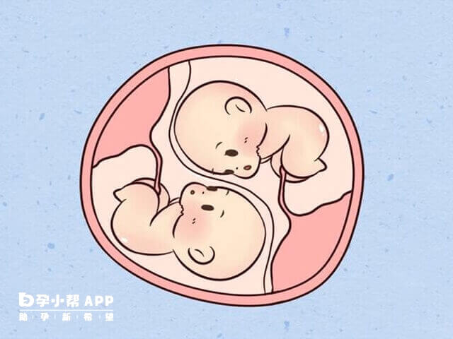 试管婴儿怀上多胞胎的生育风险较大