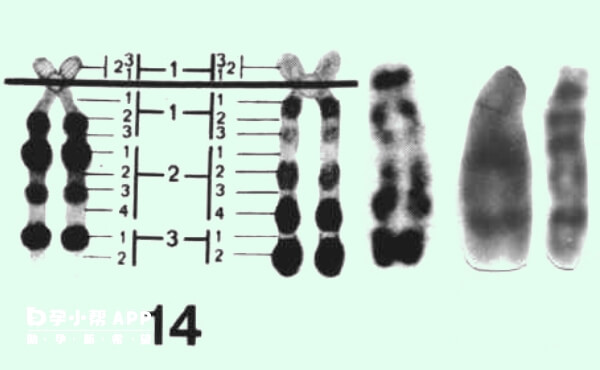14号染色体异常可做三代试管