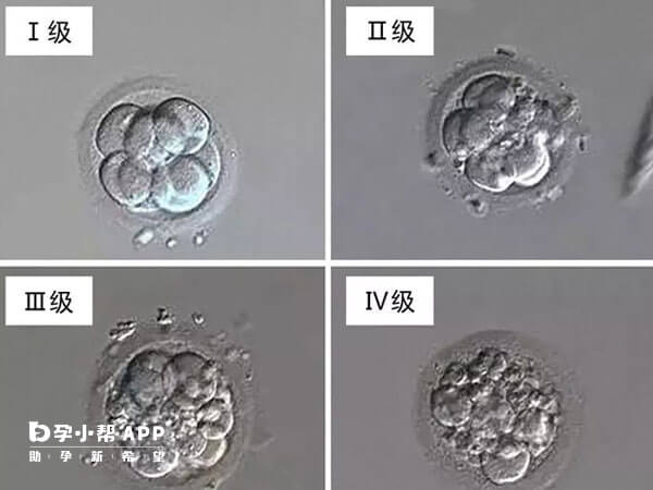 第3天胚胎可以分为四个等级