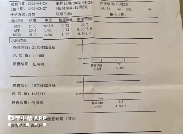 高龄相对适龄女性更容易唐筛高风险