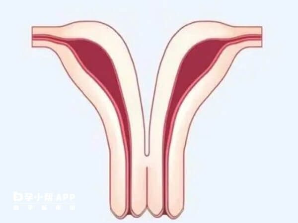 单角子宫不严重是女性怀孕的条件之一